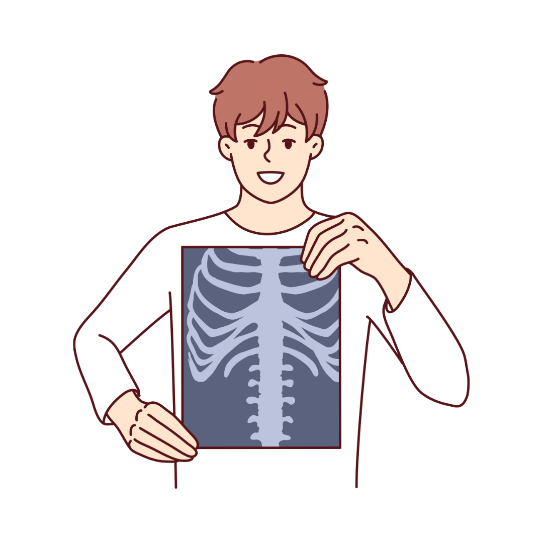 X-Ray